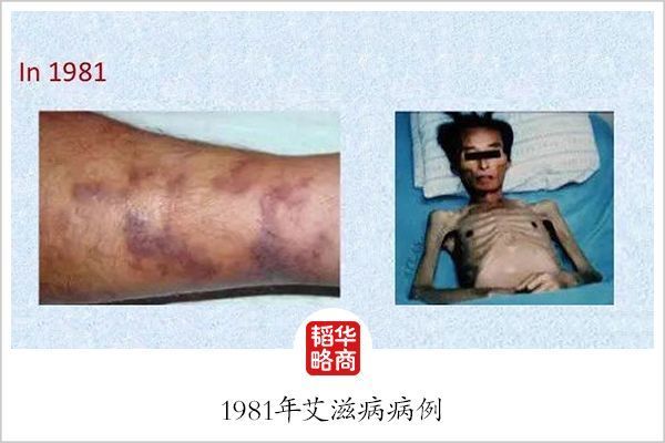 疫苗,有人用它谋财害命,有人却为它奉献一生